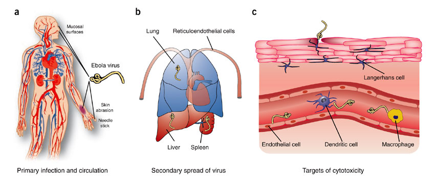 what are ebola virus symptoms